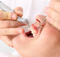 Laser Assisted Periodontal Therapy 